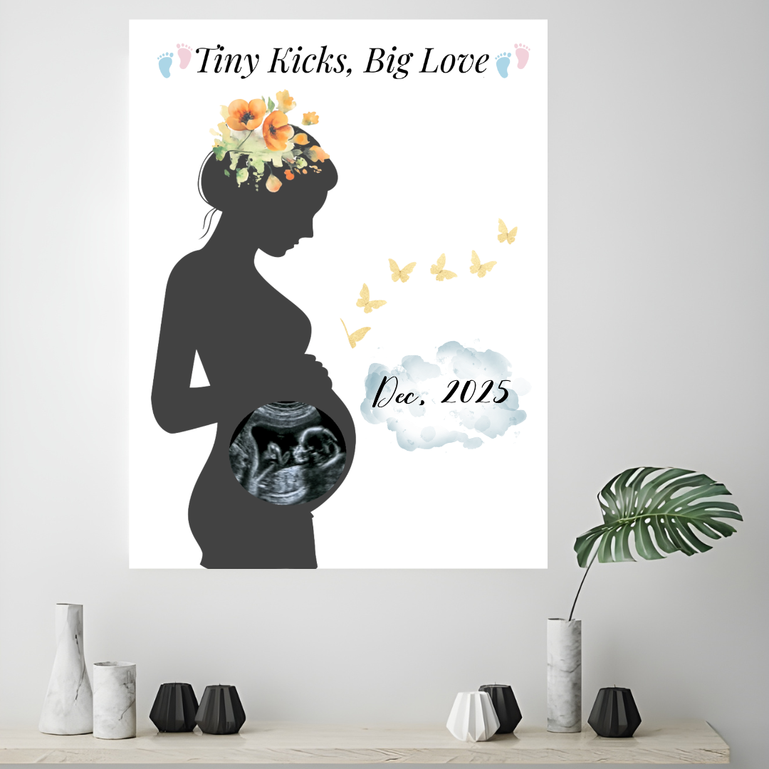 Personalized Ultrasound Frame (16×20″)